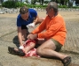 Shark attack victim in pain