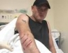 Shark attack victim with Arm injury